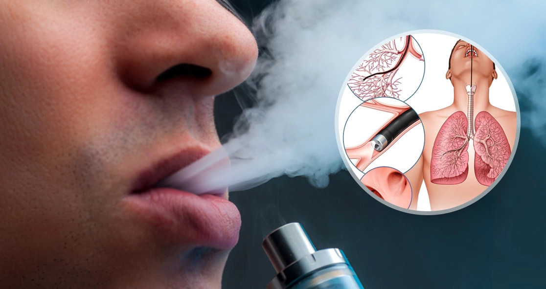 Hút vape có nguy hiểm không?